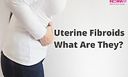 Uterine Fibroids: What Are They?