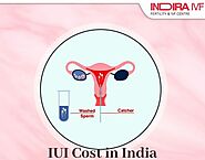 An A to Z Guide: IUI Treatment cost in India – Indira IVF