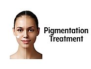 Treatments for Face Pigmentation Coogee | Skin Care in Sydney, NSW