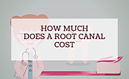How Much Does A Root Canal Cost In the USA? | 2019