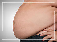 Best Obesity, Weight loss Ayurvedic Treatment in Ahmedabad, Aagyarthayurved.com | Aagyarth Ayurved