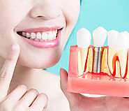 Best Teeth Whitening Treatment Available At Greenvale