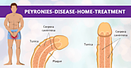 Top 5 Natural Remedies For Peyronie's Disease Home Treatment | How to Cure