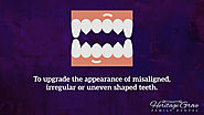 • To upgrade the appearance of misaligned, irregular or uneven shaped teeth.