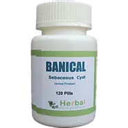 Infected Sebaceous Cyst Treatment – Supplements for Sebaceous Cyst, Reduce the size of Sebaceous Cyst