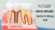 Best Dental Implant Clinic for Your Treatment