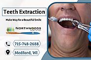 Professional Dental Extraction