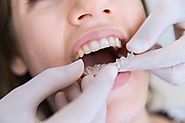 Orthodontic Treatment in Noida | Kaashvi Medident | Dr. Shalini Jain