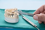 Dental Tooth Braces Treatment Noida | Kaashvi Medident | Dr. Shalini Jain