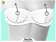 Breast augmentation in Iran - Breast implant - ir Persiatour