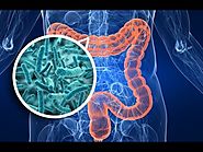 ¿Una dieta vegana o vegetariana está asociada con la composición de microbiota en el intestino? Resultados de un nuev...