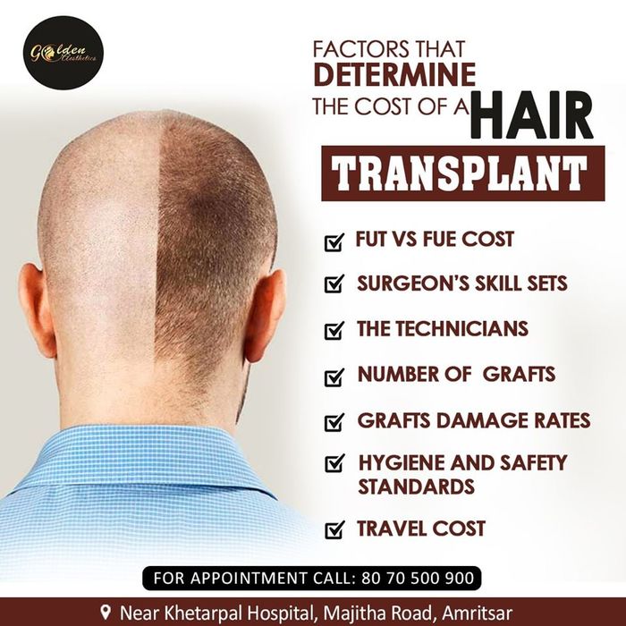Hair Transplant in Amritsar  Clinics Cost  Treatment