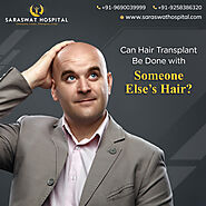 Can I Use Someone Else's Hair for A Hair Transplant?