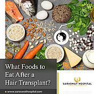 What is the Best Diet after a Hair Transplant?