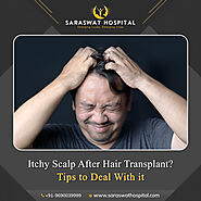 How to Deal with an Itchy Scalp after a Hair Transplant?