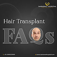 What are the Commonly Asked Questions for a Hair Transplant?