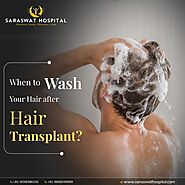 How Soon Can I Do a Hair Wash After a Hair Transplant?