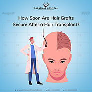How Soon Are Hair Grafts Secure After a Hair Transplant?
