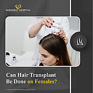 Can Women Have Hair Transplant?