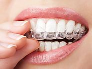 5 Interesting Things to Know About Invisalign before Taking the Plunge - Brooke Anderson