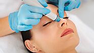 Top 9 Things You Need to Know About Laser Skin Treatment