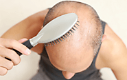 How to Grow Hair Faster And Healthier: Things to Do For Men
