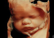 Website at https://www.sooperarticles.com/health-fitness-articles/pregnancy-articles/case-study-4d-baby-scan-clinic-u...