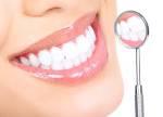 Teeth Whitening - Google Search