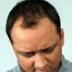 Hair Loss: Find Facts about Causes and Treatment Options