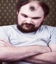 Your Diabolical Follicles: Treating Male Pattern Baldness