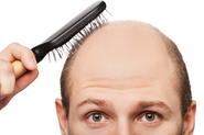 Penn dermatologist makes breakthrough in battle against hair loss