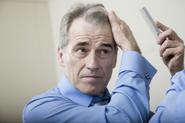 Know Your Options: Hair Loss Treatments for Men