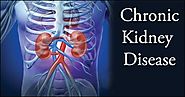 Herbal Remedies for CKD - Kidney disease treatment in Ayurveda