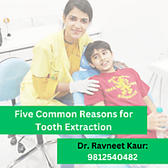 Five Common Reasons for Tooth Extraction
