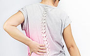 Scoliosis Treatment in India - Cost, Best Doctors & Hospitals