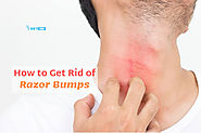 How to Get Rid of Razor Bumps Through The Five Super-Effective Ways?