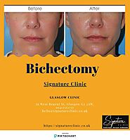 Achieve desired Appearance with Bichectomy Treatment | Signature Clinic