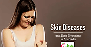 Ayurvedic treatments Centre in Delhi: Ayurveda Dermatology – Ayurvedic Perspective of Skin Diseases
