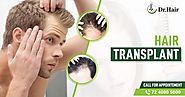 Know More About Follicular Unit Transplant from the hair specialist in jaipur