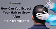 Know day by day procedure of hair growth after hair transplant