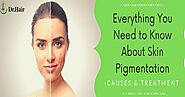Everything You Need to Know About Skin Pigmentation- Causes & Treatment