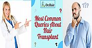 Answers to some of the most common queries about hair transplant