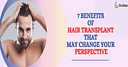 7 Benefits of Hair Transplant That May Change Your Perspective