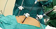 Laparoscopic Gallbladder Stone Operation: 5 Simple Tips To Follow For A Faster Recovery by Himanshu Mehera