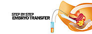 What are the important steps in Embryo Transfer?
