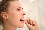 Straighten Your Teeth with Invisalign Braces in Dubai