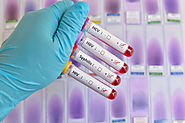 STD Testing in Dubai with Expert