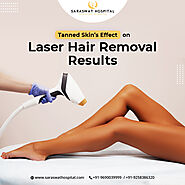 How Can Having a Tanned Skin Affect the Laser Hair Removal Results?