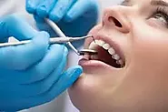 Understanding Periodontitis – Dental Health Clinic