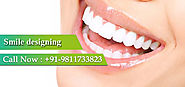 Smile Designing Treatment in Delhi, Rohini- Kapil Clinic